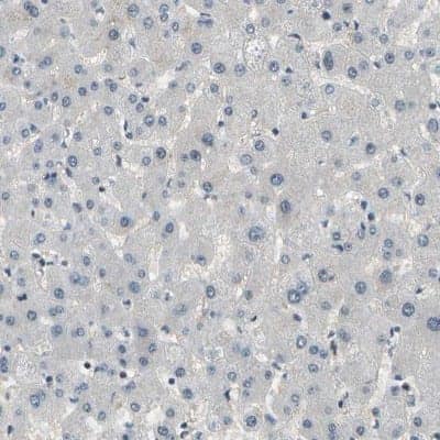 Immunohistochemistry-Paraffin ENPP-5 Antibody