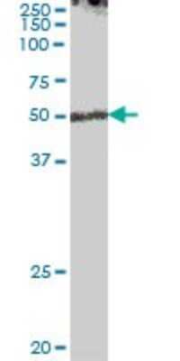 Western Blot: ENPP-7/Alk-SMase Antibody [H00339221-B01P] - Analysis of ENPP7 expression in human stomach.
