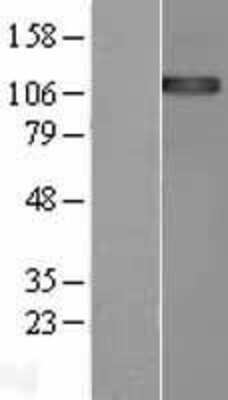 Western Blot: ENPP1 Overexpression Lysate (Adult Normal) [NBL1-10273] Left-Empty vector transfected control cell lysate (HEK293 cell lysate); Right -Over-expression Lysate for ENPP1.