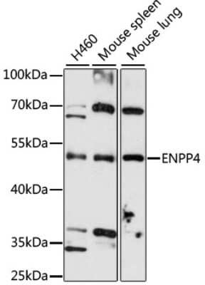 Western Blot: ENPP4 Antibody [NBP3-05178] - Analysis of extracts of various cell lines, using ENPP4 antibody at 1:3000 dilution. Secondary antibody: HRP Goat Anti-Rabbit IgG (H+L) at 1:10000 dilution. Lysates/proteins: 25ug per lane. Blocking buffer: 3% nonfat dry milk in TBST. Detection: ECL Basic Kit