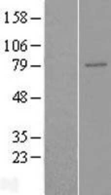 Western Blot ENPP-5 Overexpression Lysate