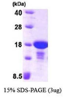 SDS-PAGE Recombinant Human alpha Endosulfine His Protein