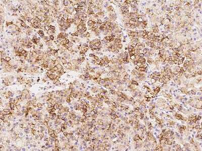 Immunohistochemistry-Paraffin: ENT1 Antibody [NBP2-97568] - Staining of human ENT1 in human adrenal gland with rabbit polyclonal antibody at 1:100 dilution. 