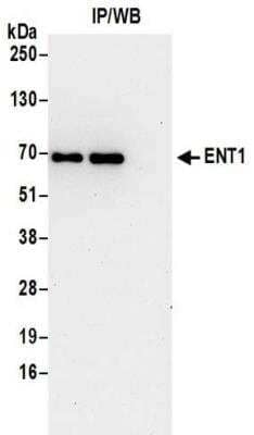 Immunoprecipitation: ENT1 Antibody [NBP2-32223] - Samples:  Whole cell lysate (0.5 or 1.0 mg per IP reaction; 20% of IP loaded) from Jurkat cells.  Antibodies:  Affinity purified rabbit anti-ENT1 antibody NBP2-32223 used for IP at 6 ug per reaction. For blotting immunoprecipitated ENT1 was used at 1 ug/ml.  Detection: Chemiluminescence with an exposure time of 30 seconds.