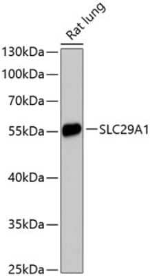 Western Blot ENT1 Antibody - Azide and BSA Free