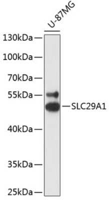 Western Blot: ENT1 Antibody [NBP3-02977] - Analysis of extracts of U-87MG cells, using ENT1 antibody at 1:3000 dilution. Secondary antibody: HRP Goat Anti-Rabbit IgG (H+L) at 1:10000 dilution. Lysates/proteins: 25ug per lane. Blocking buffer: 3% nonfat dry milk in TBST. Detection: ECL Basic Kit .
