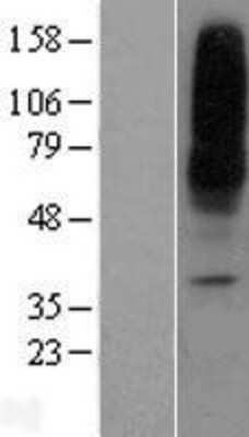 Western Blot ENT1 Overexpression Lysate