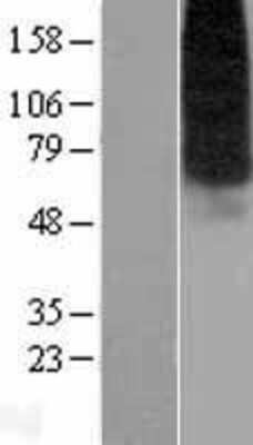 Western Blot ENT1 Overexpression Lysate