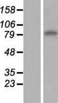 Western Blot ENT1 Overexpression Lysate