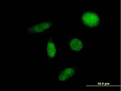 Immunocytochemistry/Immunofluorescence: ENT2 Antibody [H00003177-B02P] - Analysis of purified antibody to SLC29A2 on HeLa cell. (antibody concentration 10 ug/ml)