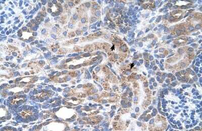 Immunohistochemistry: ENT2 Antibody [NBP1-69312] - Staining of human kidney section.