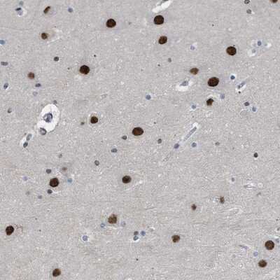 Immunohistochemistry-Paraffin: ENT2 Antibody [NBP1-85253] - Staining of human hippocampus shows strong nuclear positivity in neuronal cells.