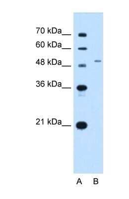 Western Blot: ENT2 Antibody [NBP1-69312] - This Anti-SLC29A2 antibody was used in Western Blot of HepG2 tissue lysate at a concentration of 2.5ug/ml.