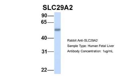 Western Blot: ENT2 Antibody [NBP1-69313] - Human Fetal Liver, Antibody Dilution: 1.0 ug/ml.