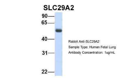 Western Blot: ENT2 Antibody [NBP1-69313] - Human Fetal Lung, Antibody Dilution: 1.0 ug/ml.