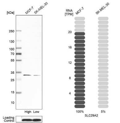 Western Blot: ENT2 Antibody [NBP1-85253] - Analysis in human cell line MCF-7 and human cell line SK-MEL-30.