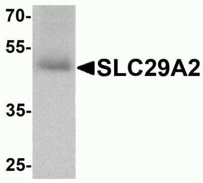 Western Blot: ENT2 Antibody [NBP2-81984] - Analysis of ENT2 in human bladder tissue lysate with ENT2 antibody at 1 ug/ml.