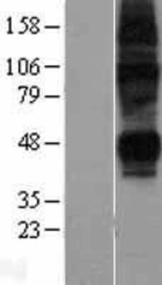 Western Blot: ENT2 Overexpression Lysate (Adult Normal) [NBL1-16092] Left-Empty vector transfected control cell lysate (HEK293 cell lysate); Right -Over-expression Lysate for ENT2.