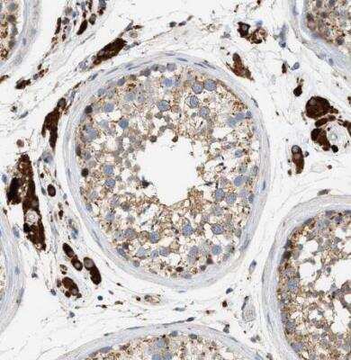 Immunohistochemistry-Paraffin: ENTHD1 Antibody [NBP1-93911] -  Staining of human testis shows strong cytoplasmic positivity in Leydig cells while moderate staining in cells in seminiferous ducts.