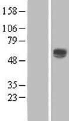 Western Blot CD39L1/ENTPD2 Overexpression Lysate