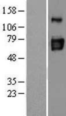 Western Blot: ENTPD3 Overexpression Lysate (Adult Normal) [NBL1-10282] Left-Empty vector transfected control cell lysate (HEK293 cell lysate); Right -Over-expression Lysate for ENTPD3.
