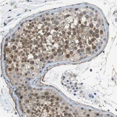 Immunohistochemistry-Paraffin: ENTPD7 Antibody [NBP1-82030] - Staining of human testis shows moderate nuclear(nucleolar) and cytoplasmic positivity in cells in seminiferus ducts.