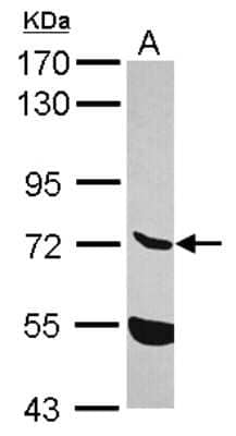 Western Blot: ENTPD7 Antibody [NBP2-16343] - Sample (30 ug of whole cell lysate) A: NT2D1 7. 5% SDS PAGE gel, diluted at 1:1000.