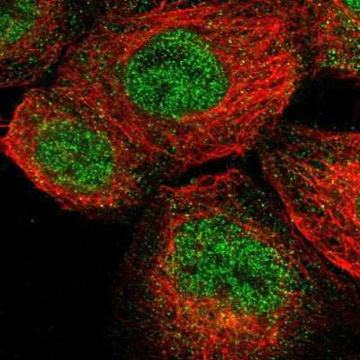 Immunocytochemistry/ Immunofluorescence ENTPD8 Antibody