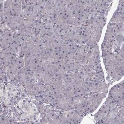 Immunohistochemistry-Paraffin ENTPD8 Antibody