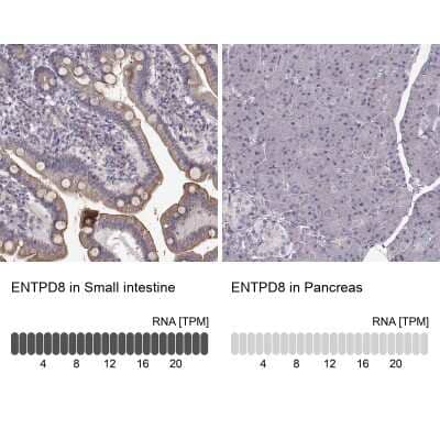 Immunohistochemistry-Paraffin ENTPD8 Antibody