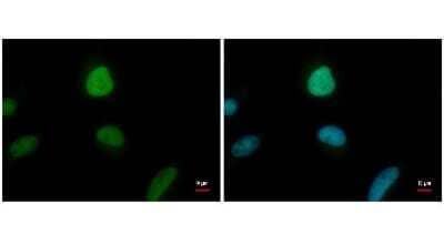 Immunocytochemistry/Immunofluorescence: ENY2 Antibody (245) [NBP2-43547] - Analysis of HeLa cells were fixed in 4% paraformaldehyde/PBS for 15 min. Green: ENY2 protein stained by ENY2 antibody diluted at 1:500. Blue: Hoechst 33342 staining.
