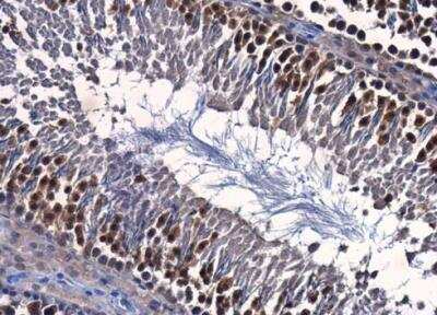 Immunohistochemistry-Paraffin ENY2 Antibody (245) - Azide and BSA Free