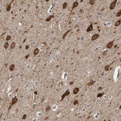 Immunohistochemistry-Paraffin: ENY2 Antibody [NBP1-90598] - Staining of human cerebral cortex shows strong cytoplasmic and nuclear positivity in neuronal cells.