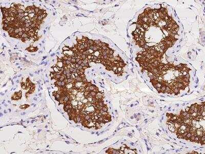 Immunohistochemistry-Paraffin: ENY2 Antibody [NBP3-06133] - Immunochemical staining of human ENY2 in human testis with rabbit polyclonal antibody at 1:500 dilution, formalin-fixed paraffin embedded sections.
