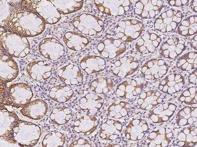 Immunohistochemistry-Paraffin ENY2 Antibody - BSA Free