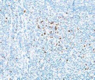 Immunohistochemistry: EOMES Antibody (BLR104H) [NBP3-07014] -  Human EOMES in tonsil by IHC. Antibody: Rabbit anti-EOMES recombinant monoclonal antibody [BLR104H]. Secondary: HRP-conjugatedgoat anti-rabbit IgG. Substrate: DAB.