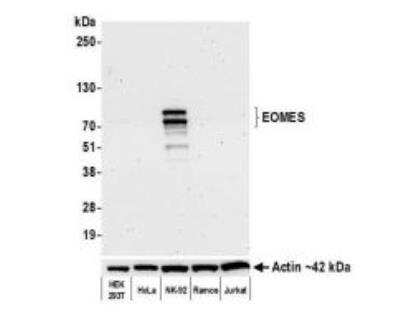 Western Blot: EOMES Antibody (BLR104H) [NBP3-07014] - Whole cell lysate (10 ug) from HEK293T, HeLa, NK-92, Ramos, and Jurkat cells prepared using NETN lysis buffer. Antibody: Rabbit anti-EOMES recombinant monoclonal antibody [BLR104H]  used at 1:1000. Secondary: HRP-conjugated goat anti-rabbit IgG.  Chemiluminescence with an exposure time of 75 seconds. Lower Panel: Rabbit anti-Actin recombinant monoclonal antibody [BLR057F]. 