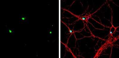 Immunocytochemistry/Immunofluorescence: EOMES Antibody [NBP3-13356] - EOMES antibody detects EOMES protein by immunofluorescent analysis. Sample: DIV9 rat E18 primary hippocampal neuron cells were fixed in 4% paraformaldehyde at RT for 15 min. Green: EOMES stained by EOMES antibody (NBP3-13356) diluted at 1:500. Red: beta Tubulin 3/ Tuj1, stained by beta Tubulin 3/ Tuj1 antibody [GT11710] (NBP2-43559) diluted at 1:500. Blue: Fluoroshield with DAPI.