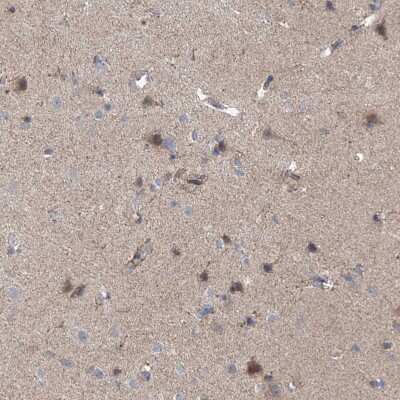 Immunohistochemistry-Paraffin: EOMES Antibody [NBP1-80699] - Staining of human cerebral cortex shows moderate nuclear positivity in neurons.