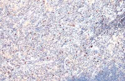 Immunohistochemistry-Paraffin: EOMES Antibody [NBP3-13136] - EOMES antibody detects EOMES protein at nucleus by immunohistochemical analysis. Sample: Paraffin-embedded mouse thymus gland. EOMES stained by EOMES antibody (NBP3-13136) diluted at 1:500. Antigen Retrieval: Citrate buffer, pH 6.0, 15 min