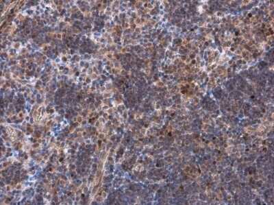 Immunohistochemistry-Paraffin: EOMES Antibody [NBP3-13356] - EOMES antibody detects TBR2 protein at nucleus by immunohistochemical analysis. Sample: Paraffin-embedded rat lymph node. TBR2 stained by EOMES antibody (NBP3-13356) diluted at 1:500. Antigen Retrieval: Citrate buffer, pH 6.0, 15 min