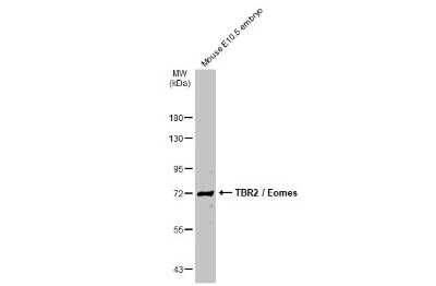 Western Blot: EOMES Antibody [NBP3-13136] - Mouse tissue extract (50 ug) was separated by 7.5% SDS-PAGE, and the membrane was blotted with EOMES antibody (NBP3-13136) diluted at 1:1000. The HRP-conjugated anti-rabbit IgG antibody (NBP2-19301) was used to detect the primary antibody.