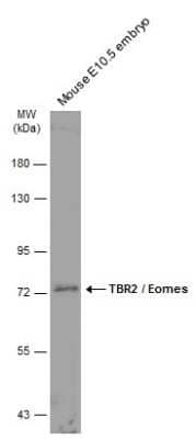 Western Blot: EOMES Antibody [NBP3-13356] - Mouse tissue extract (50 ug) was separated by 7.5% SDS-PAGE, and the membrane was blotted with EOMES antibody (NBP3-13356) diluted at 1:1000. The HRP-conjugated anti-rabbit IgG antibody (NBP2-19301) was used to detect the primary antibody.