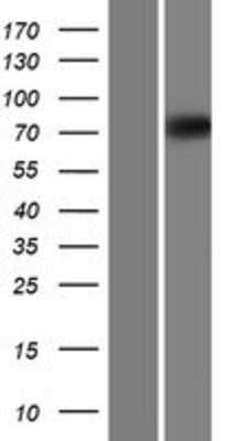 Western Blot: EOMES Overexpression Lysate (Adult Normal) [NBL1-10285] Left-Empty vector transfected control cell lysate (HEK293 cell lysate); Right -Over-expression Lysate for EOMES.