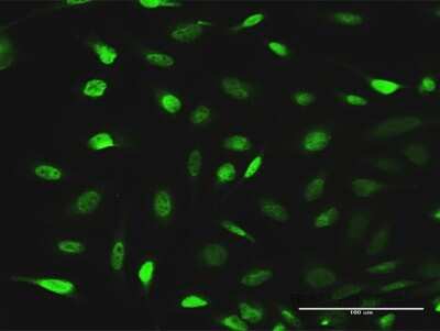 Immunocytochemistry/Immunofluorescence: EPB41L1 Antibody [H00002036-D01P] - Analysis of antibody to EPB41L1 on HeLa cell. Antibody concentration 10 ug/ml.