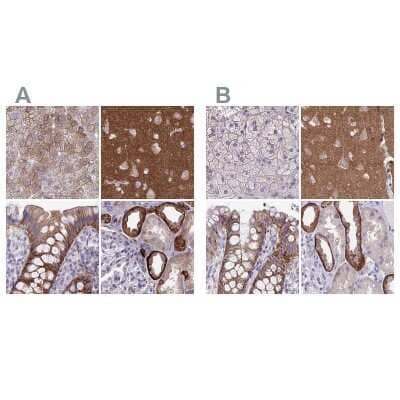 <b>Independent Antibodies Validation. </b>Immunohistochemistry-Paraffin: EPB41L1 Antibody [NBP2-31572] - Staining of human adrenal gland, cerebral cortex, colon and kidney using Anti-EPB41L1 antibody NBP2-31572 (A) shows similar protein distribution across tissues to independent antibody NBP2-31650 (B).