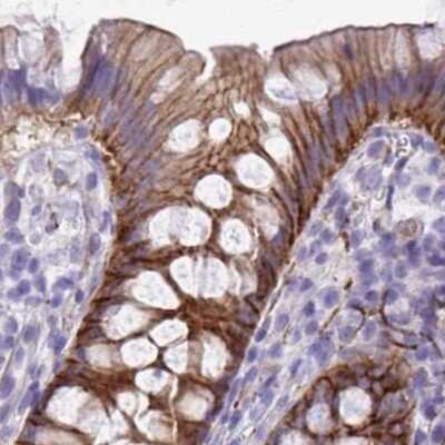 Immunohistochemistry-Paraffin: EPB41L1 Antibody [NBP2-31572] - Staining of human colon.