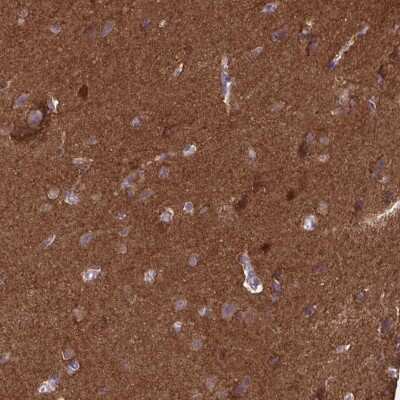 Immunohistochemistry-Paraffin: EPB41L1 Antibody [NBP2-31650] - Staining of human cerebral cortex shows strong positivity in neuropil and a subset of glial cells.