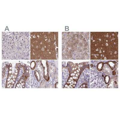 <b>Independent Antibodies Validation. </b>Immunohistochemistry-Paraffin: EPB41L1 Antibody [NBP2-31650] - Staining of human adrenal gland, cerebral cortex, colon and kidney using Anti-EPB41L1 antibody NBP2-31650 (A) shows similar protein distribution across tissues to independent antibody NBP2-31572 (B).