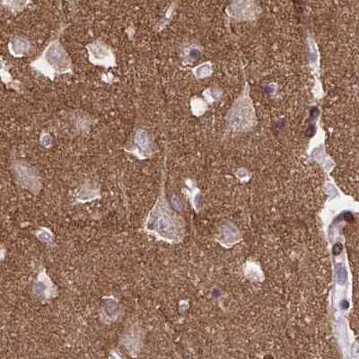 Immunohistochemistry-Paraffin: EPB41L1 Antibody [NBP2-31650] - Staining of human cerebral cortex.